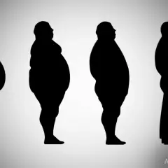 Siluetas humanas muestran la progresión de la diferencia entre sobrepeso y obesidad, desde un cuerpo muy obeso hasta uno con peso saludable.
