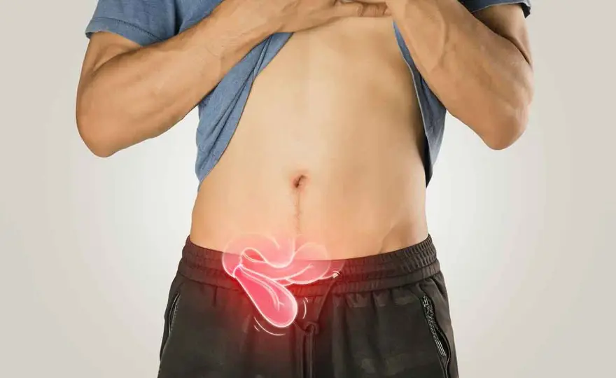 ¿Qué puede ser un bulto en la ingle y cuándo consultar?